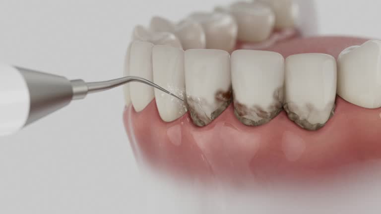 Trusted Tooth Extraction service in Calverton, MD - Dentist Open Now